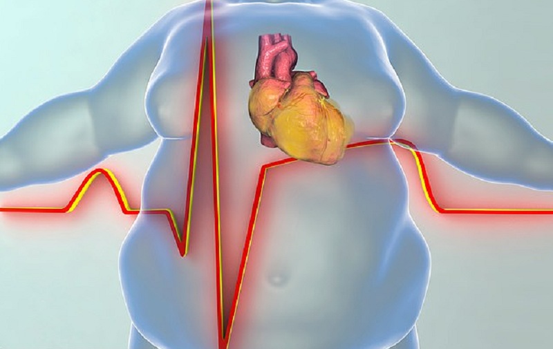 Nghiên cứu cho thấy giảm cân giúp cải thiện sức khỏe tim mạch