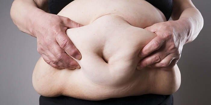 Béo phì và tiểu đường: Thực trạng báo động toàn cầu