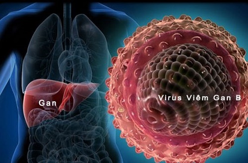 Biến chứng nguy hiểm của bệnh viêm gan