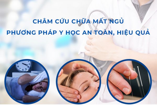 Nên chọn giải pháp phù hợp và an toàn khi trị mất ngủ