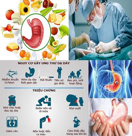 Thuốc nam hỗ trợ điều trị dạ dày - thực hư thế nào?