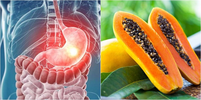 Nên ứng dụng đu đủ như thế nào khi bị loét dạ dày?