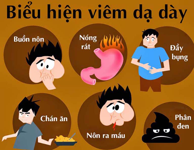 Triệu chứng viêm loét dạ dày thường bị bỏ qua