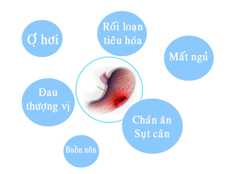 Những dấu hiệu cảnh báo viêm loét dạ dày