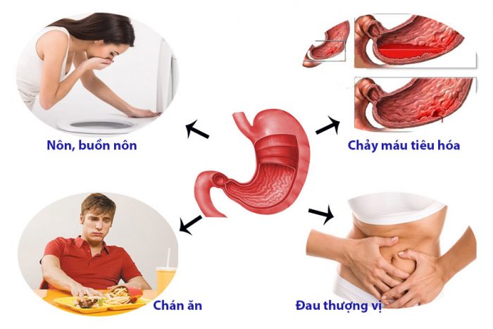 Lưu ý khi dùng thuốc nam hỗ trợ đau dạ dày