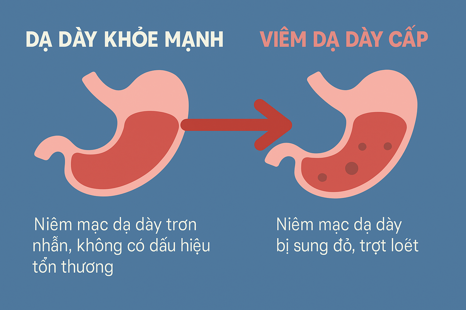 Nguy cơ biến chứng từ việc tự điều trị dạ dày