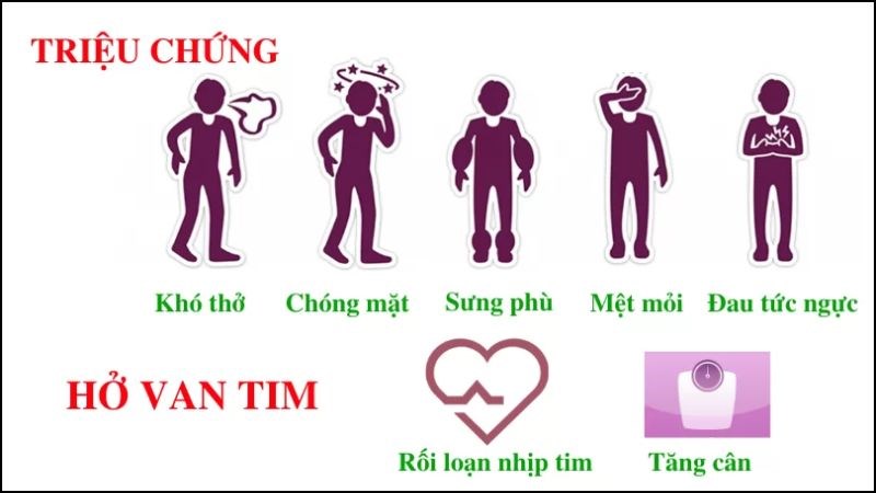 Giải phẫu van tim, phân loại hở các van phổ biến trong bệnh học tim mạch