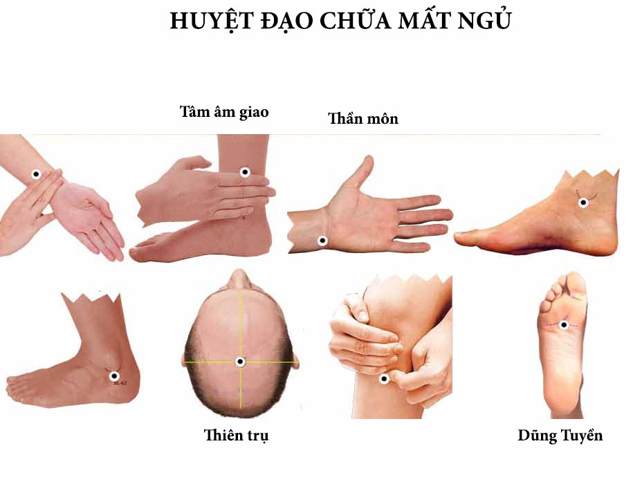 Huyệt quan trọng giúp cải thiện giấc ngủ
