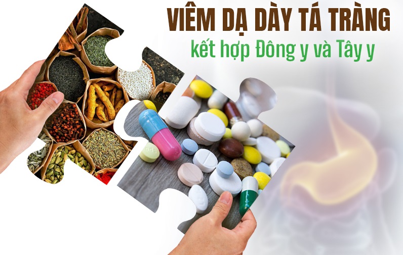 Cảnh báo rủi ro khi dùng sai thuốc nam chữa dạ dày