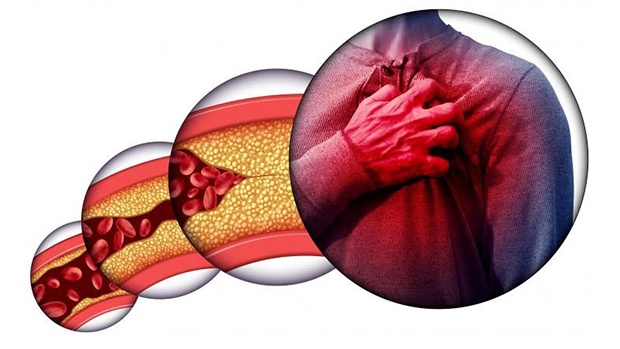 Uống thảo dược hỗ trợ dưỡng tim và giảm cholesterol