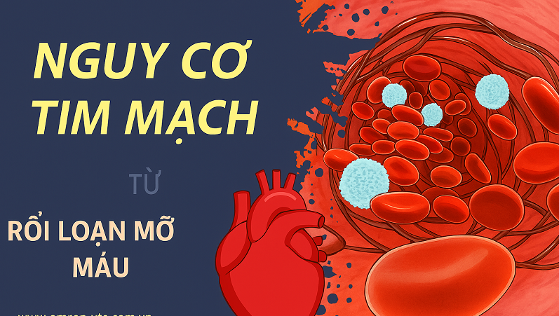 Hình ảnh liên quan mỡ máu và tim mạch