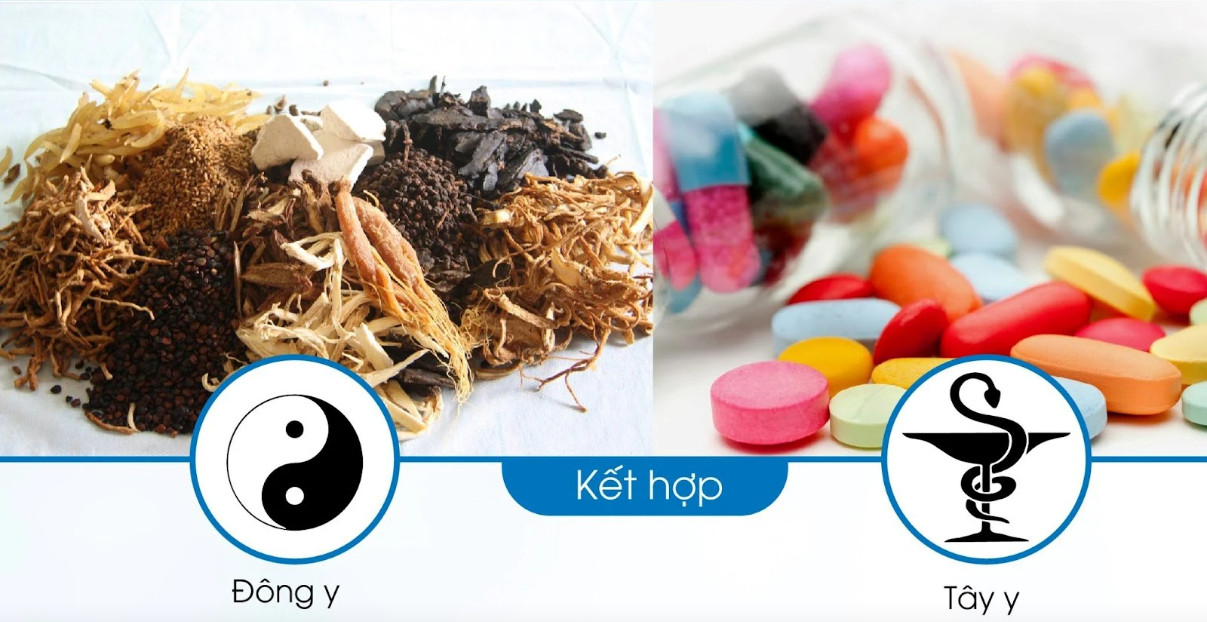 Kết hợp thuốc nam và tây y hợp lý trong điều trị loét dạ dày