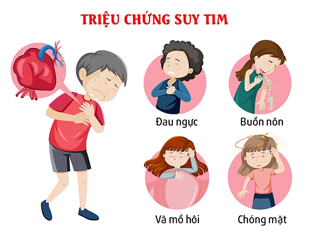 Suy tim là gì? Dấu hiệu nhận biết tình trạng bệnh tim mạch