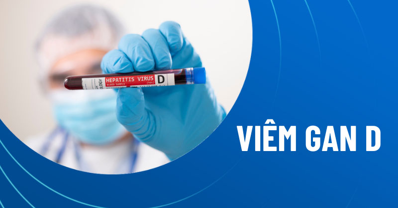 So sánh mức độ nguy hiểm giữa các loại viêm gan