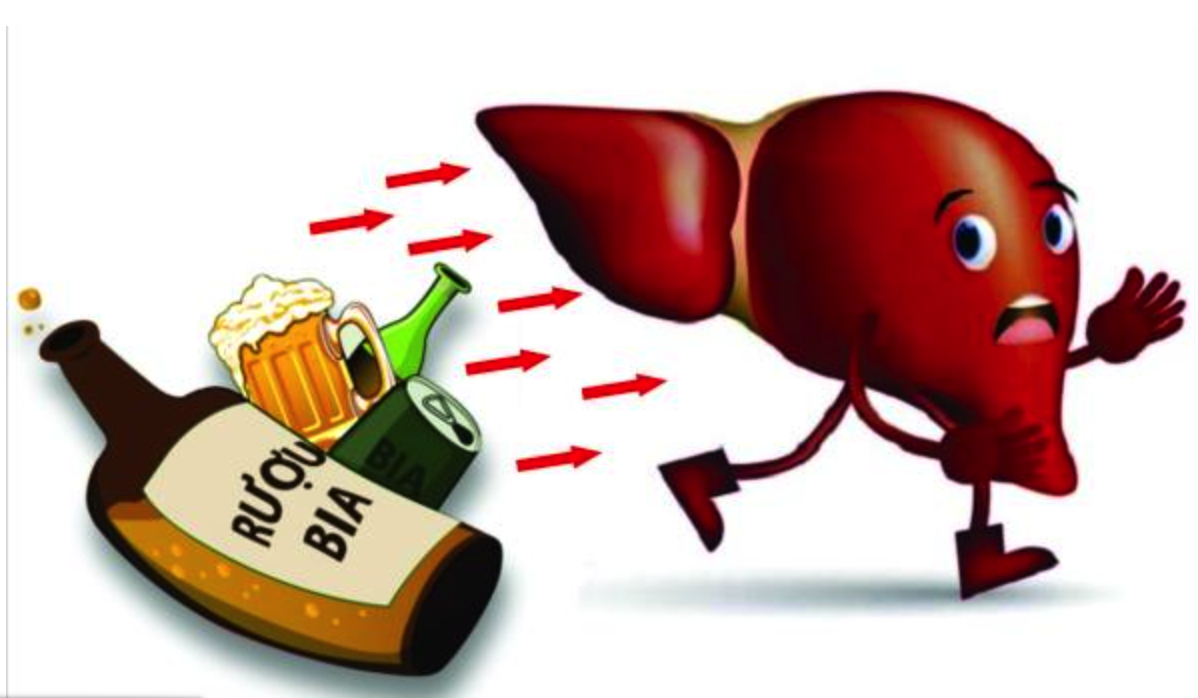 Tác động của rượu bia đến gan người Việt