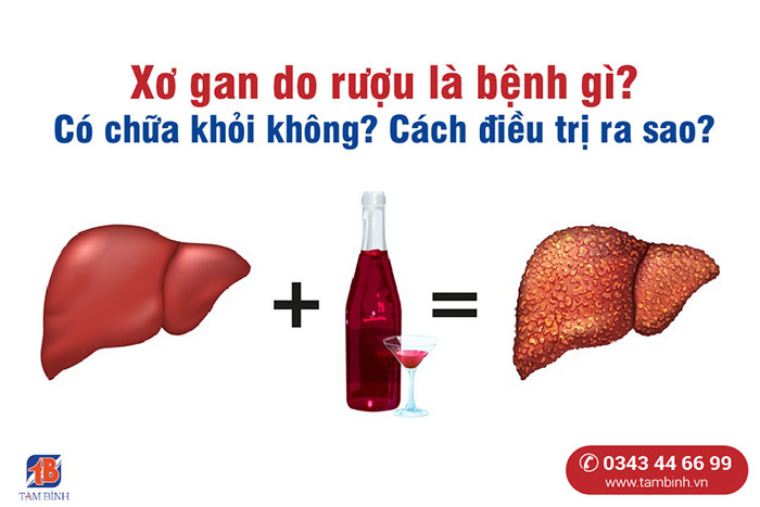 Thảo dược thiên nhiên hỗ trợ điều trị viêm gan