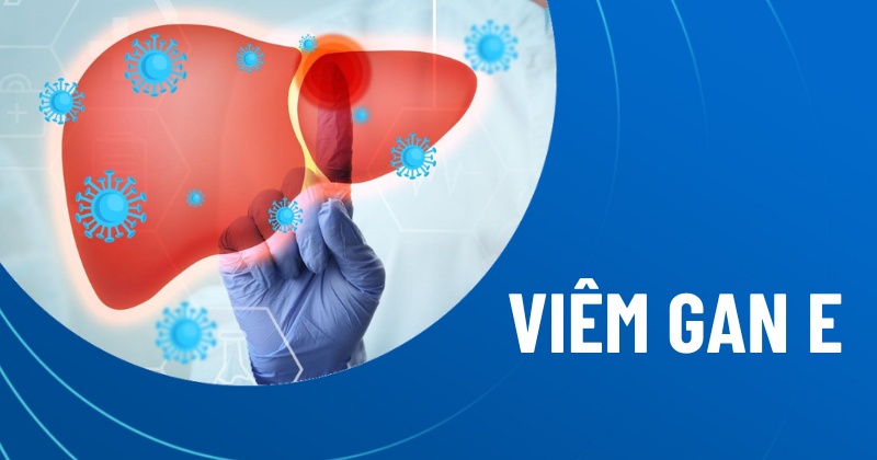 Hình minh họa về viêm gan E và con đường lây nhiễm