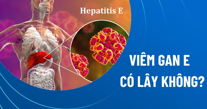 Hình ảnh minh họa biến chứng và mức độ nguy hiểm của bệnh viêm gan E
