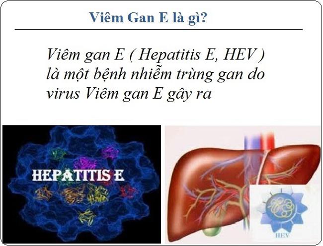 Các phương pháp phòng ngừa và thảo dược hỗ trợ phòng trị viêm gan E tại Tấn Phát