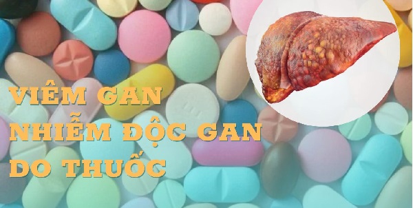 Nguy cơ viêm gan do lạm dụng thuốc tây