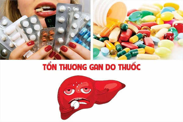 Gan phải chuyển hóa thuốc tây và nguy cơ tích tụ độc tố