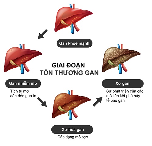 Viêm gan là gì