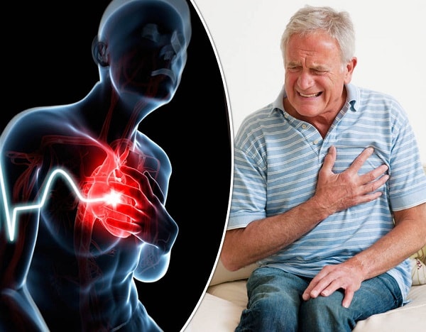 Nhận biết dấu hiệu báo động cấp, biết sơ cứu đúng hạn có thể cứu mạng người thân khi đau thắt ngực và triệu chứng não