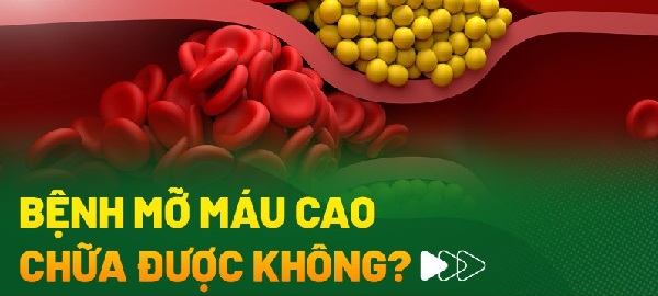 Chế độ ăn nhiều dầu mỡ là nguyên nhân chính gây tăng mỡ máu