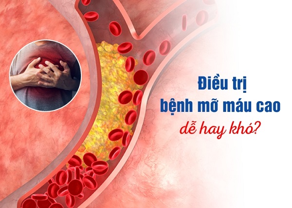 Khám sức khỏe định kỳ vẫn là yếu tố quyết định