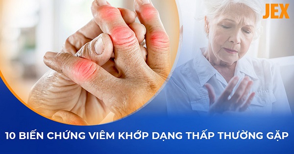 Nguy cơ biến chứng viêm khớp dạng thấp lên các cơ quan