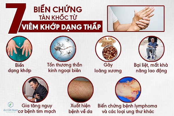 Lời khuyên khi điều trị viêm khớp dạng thấp bằng thảo dược