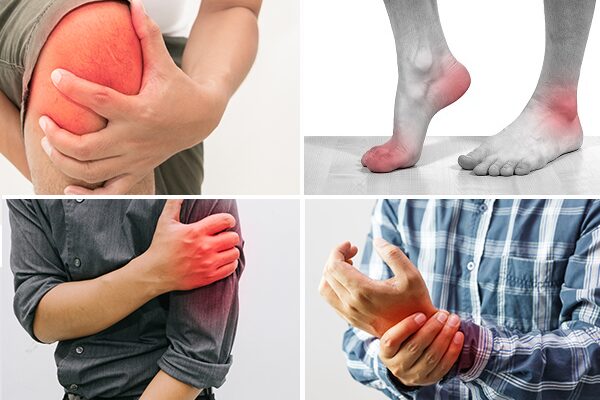 Di chứng nguy hiểm của viêm khớp nhiễm khuẩn