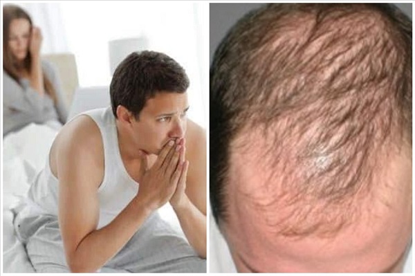 Dấu hiệu testosterone thấp dễ bị nam giới bỏ qua