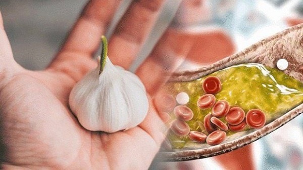 Thực phẩm nhiều dầu mỡ – nguyên nhân khiến mỡ máu tăng cao