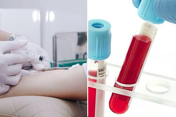 Lưu ý khi điều trị viêm gan bằng thảo dược
