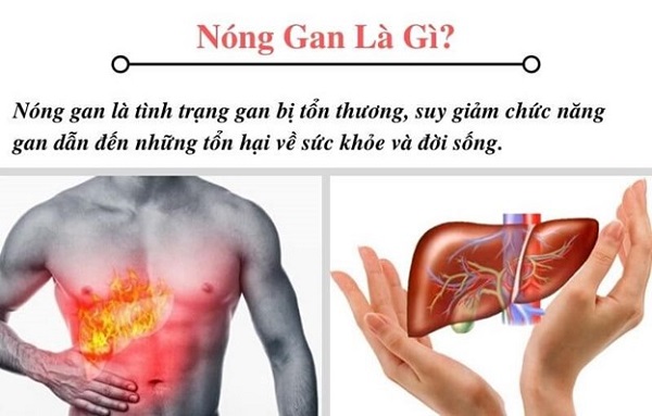 Khám điều trị nóng gan tại các cơ sở y tế