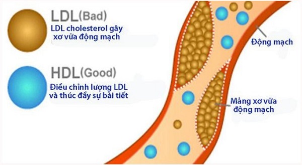 Xét nghiệm mỡ máu và ý nghĩa các chỉ số