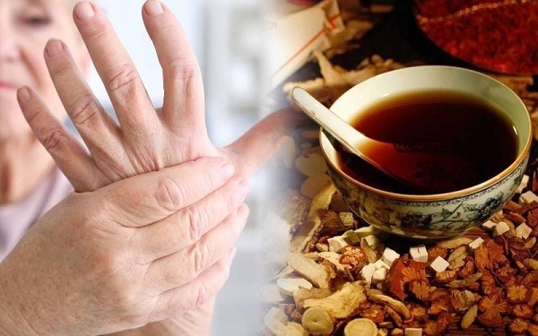 Nhiều người lựa chọn thảo dược Đông Y để điều trị viêm khớp
