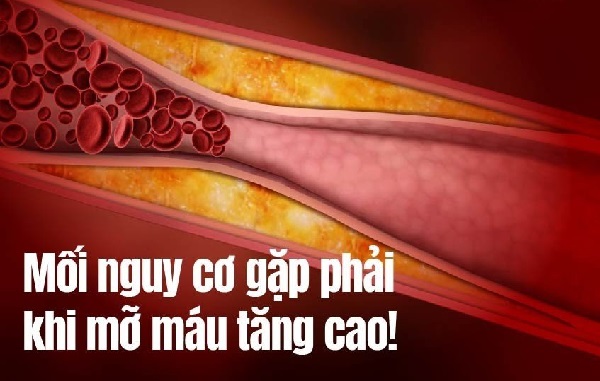 Chủ quan với dấu hiệu mỡ máu có thể dẫn đến hậu quả đáng tiếc