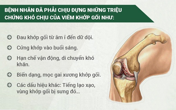 Dấu hiệu viêm khớp nhiễm khuẩn ở người trưởng thành