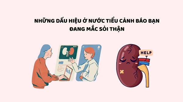 Nguy cơ và lợi ích phát hiện sớm sỏi thận