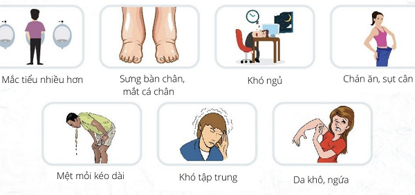 Giải pháp hỗ trợ phòng ngừa sỏi thận từ thảo dược thiên nhiên