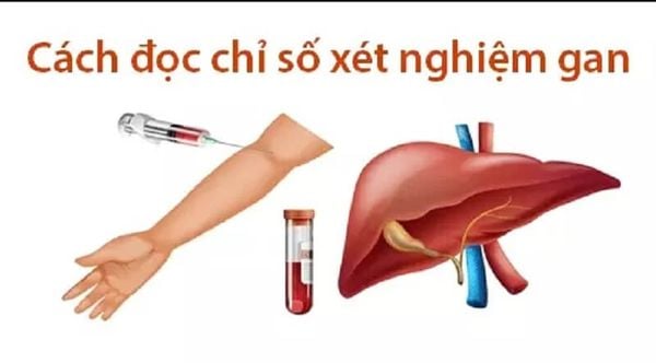 Các chỉ số xét nghiệm cần biết khi mắc bệnh viêm gan
