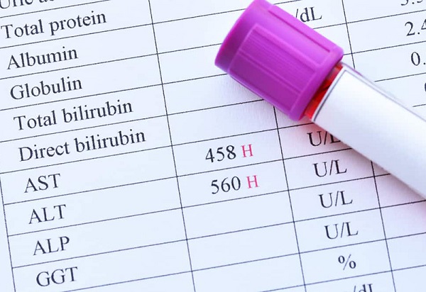 Cách đọc chỉ số viêm gan đúng và những trường hợp cần lưu ý