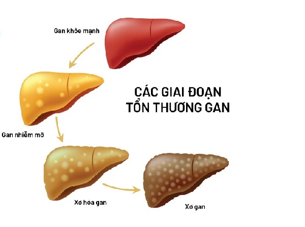 Rối loạn tiêu hóa, ngứa ngáy, nổi mề đay khi nóng gan kéo dài