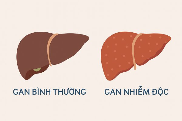 Nguy cơ khi tự ý giải độc gan không đúng cách