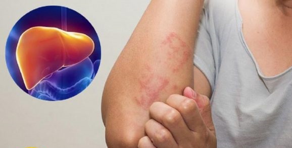 Kiểm tra sức khỏe gan tại nhà