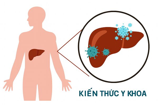 Hình ảnh minh họa về liệu trình điều trị viêm gan B