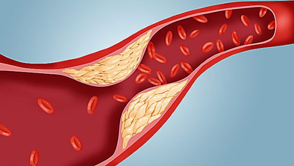 So sánh yến mạch với ngũ cốc khác