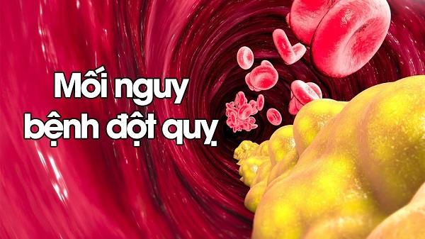 Thảo dược hỗ trợ điều trị mỡ máu cần kiểm định rõ ràng